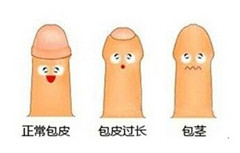 阳江包皮过长给男性带来了藏匿性痛苦