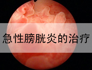 膀胱炎的危害,<a class='link_keywords' href='http://www.yjrj120.com/'>阳江仁济医院</a> 